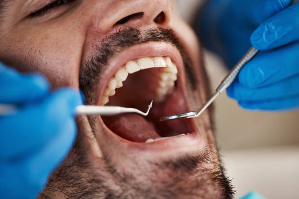 Best Dentist for Tooth Abscess  in Keokuk, IA